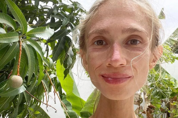 Умерла девушка, питавшаяся только фруктами — она весила чуть больше 20 кг